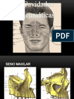Cavidades Neumáticas