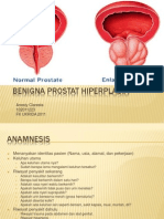 Benigna Prostat Hiperplasia