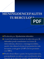 Meningoencefalitis Tuberculosa