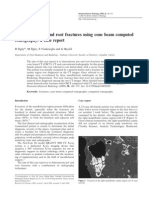 Detection of Jaw and Root Fractures Using Cone Beam Computed Tomography: A Case Report