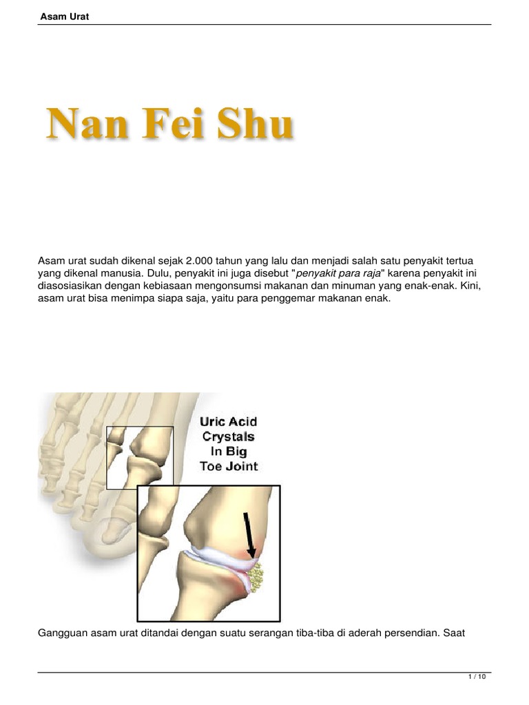 Asam Urat Wikipedia Bahasa Indonesia Ensiklopedia Bebas