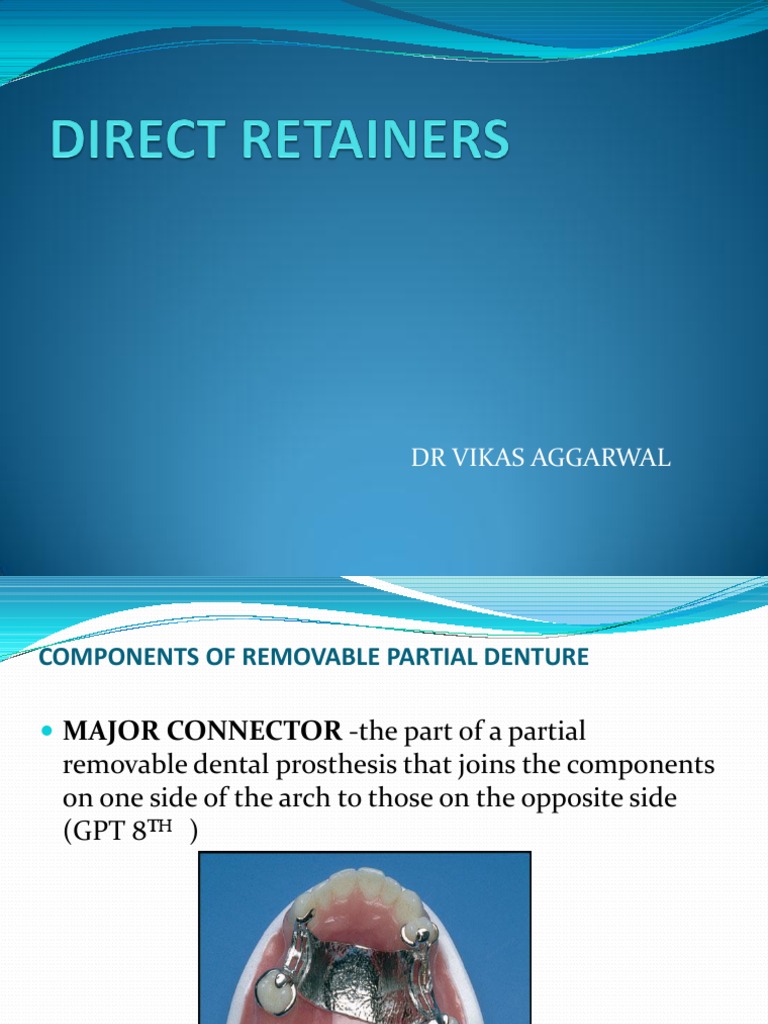 direct retainer (dr vikas ppt.ppt Dentures Mouth