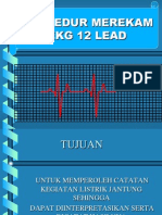 Ekg