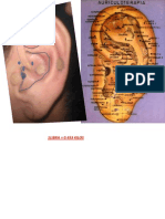 Puntos de Auriculoterapia