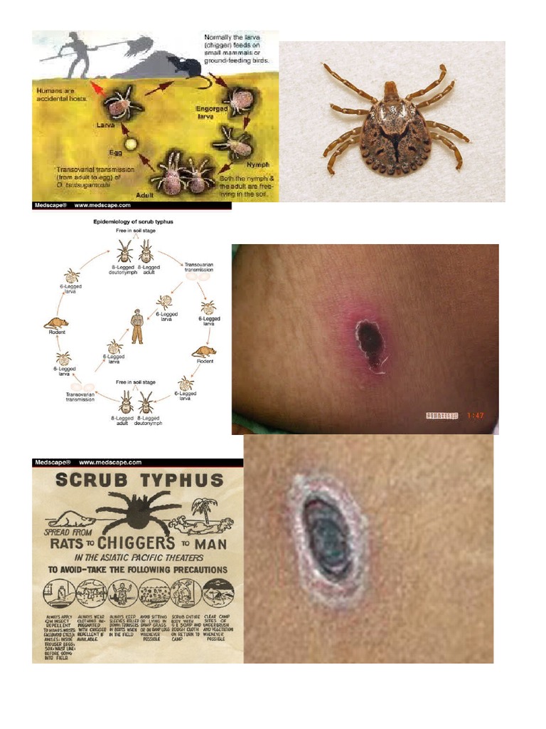 scrub typhus.doc Veterinary Medicine Clinical Pathology