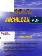 Spondilita