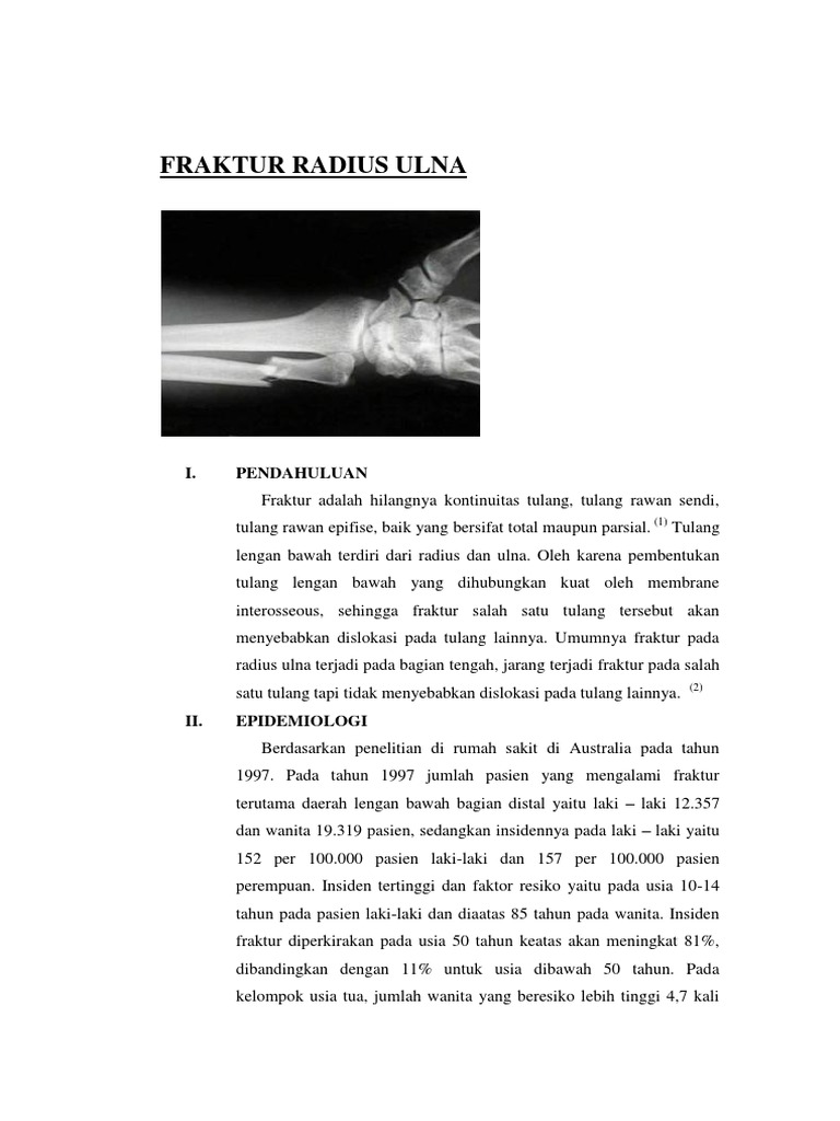 Fraktur Radius Ulna | PDF