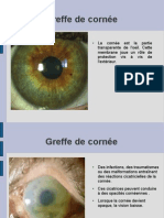 Corneal Transplantation