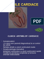 Aritmiile Prezentare