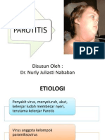 Parotitis