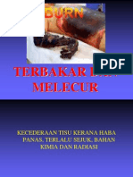 Terbakar Dan Melecur366