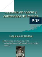 Displasia de Cadera