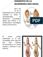 Tratamiento de la hiperbilirrubinemia neonatal