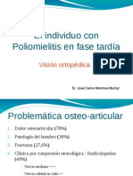 El individuo con Poliomielitis en fase tardía