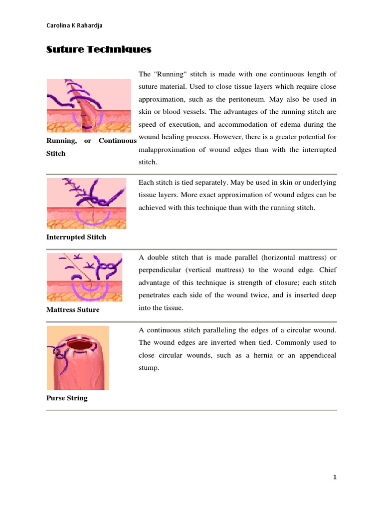 Suture Techniques | PDF
