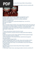 Download Sistem Klasifikasi Edentulous Sebagian2docx by Intan Permata Asti SN179480090 doc pdf