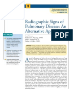 Radiographic Signs of Pulmonar Disease
