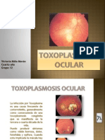 Toxoplasmosis Ocular