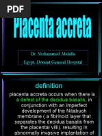 Download Placenta Accreta by khadzx SN18005693 doc pdf