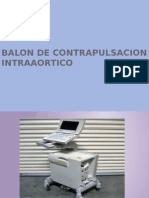 Balon de Contrapulsacion Intraaortico