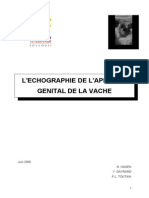 Poly Echographie