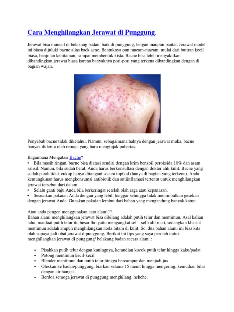 Cara Menghilangkan Jerawat Di Punggung Pdf