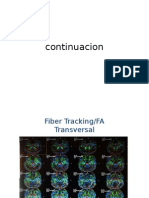 Continuacion Tecnicas