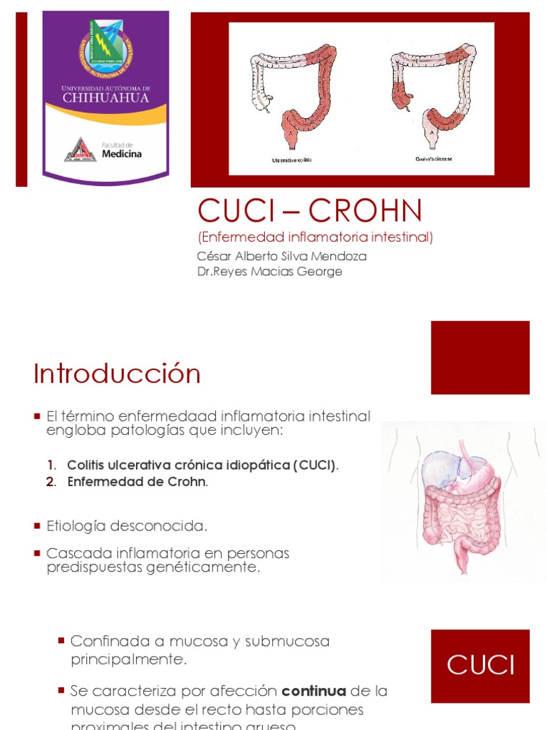 Cuci Crohn | PDF | Enfermedad de Crohn | Diarrea