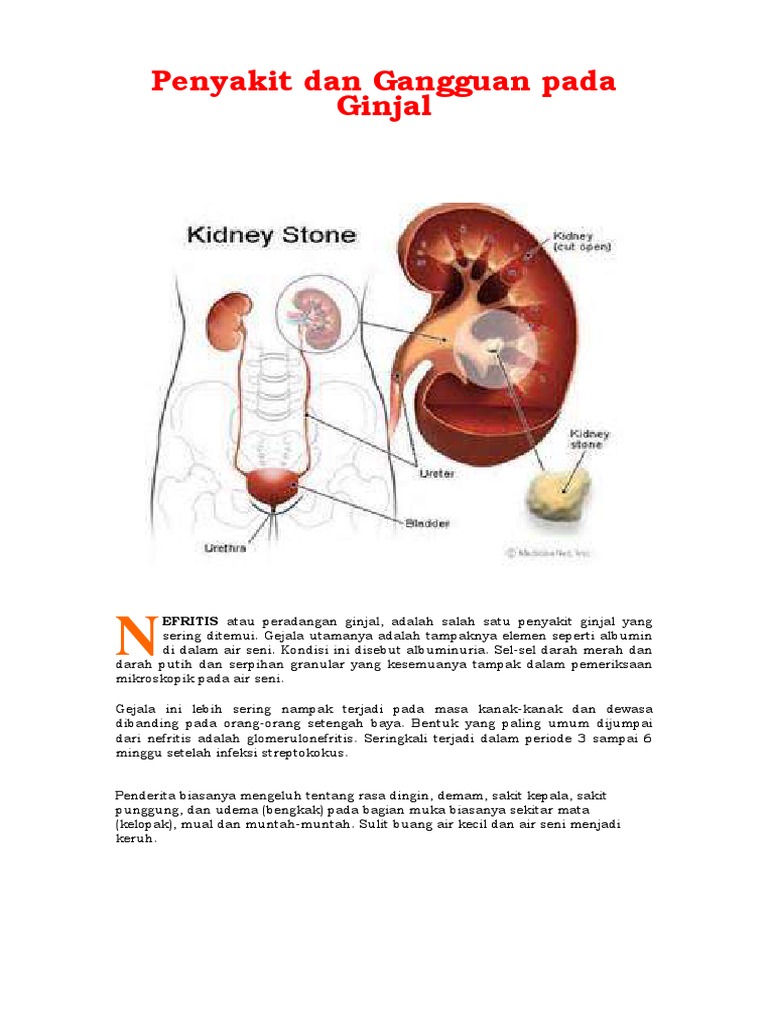 Download 980 Koleksi Gambar Ginjal Penderita Nefritis Paling Baru HD