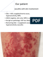 Our Patient: - Small Vessel Vasculitis With Skin Involvement Only