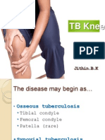 Tuberculosis of Knee