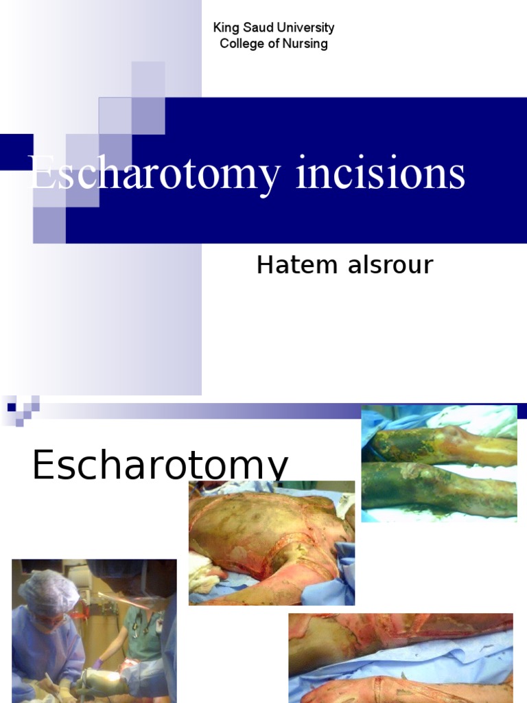 Escharotomy Incisions Medical Specialties Clinical Medicine