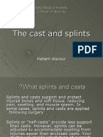 The Cast and Splints