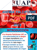 Anemia Falciforme Expo-laiza