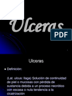Ulceras Diapositivas