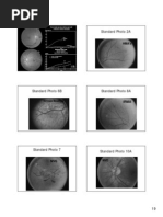 Download diabetic retinopathy by cmircea SN182535728 doc pdf