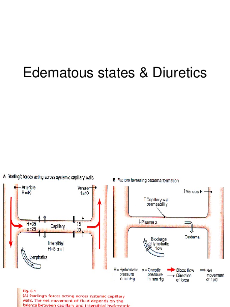 Edematous states & Diuretics.ppt Edema Heart Failure