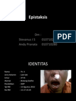 Presentasi Kasus 1 (Epistaksis)