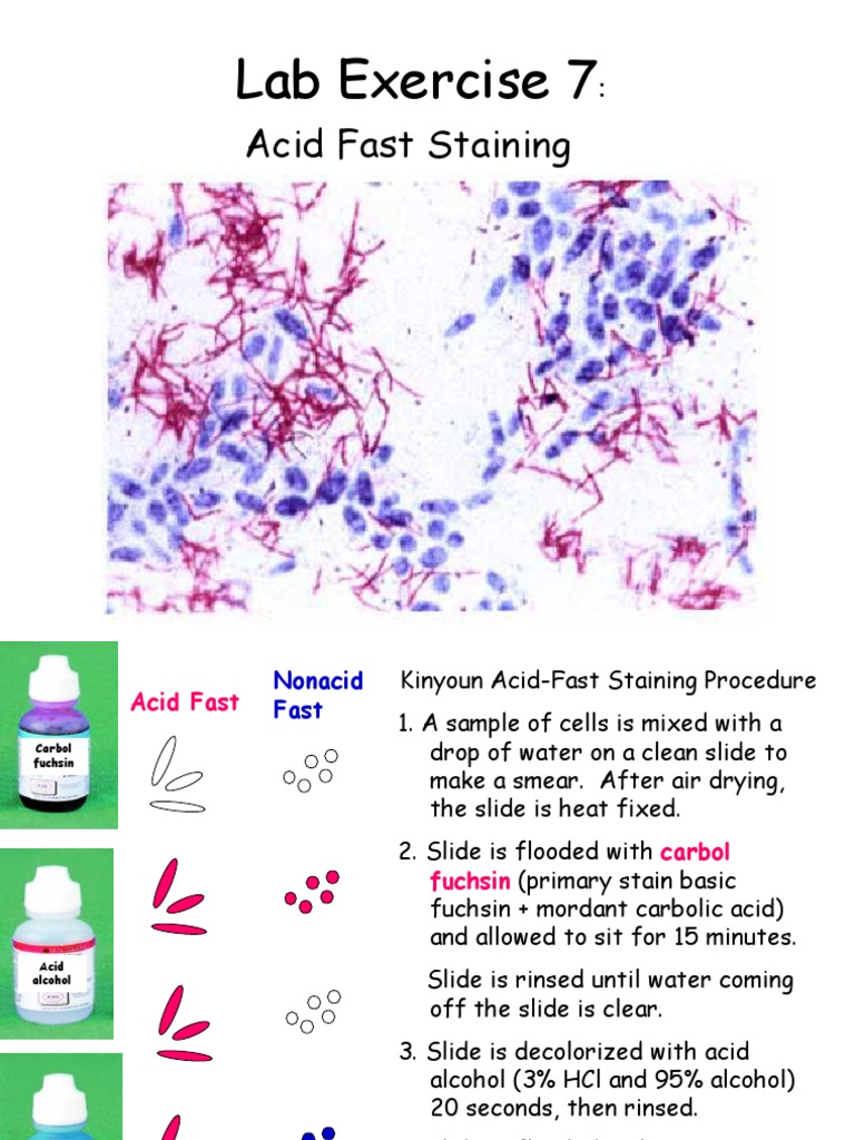 Acid Fast Staining Lab Exercise PDF