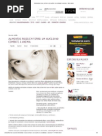 Alimentos ricos em ferro um auxílio no combate à anemia - Bem-estar