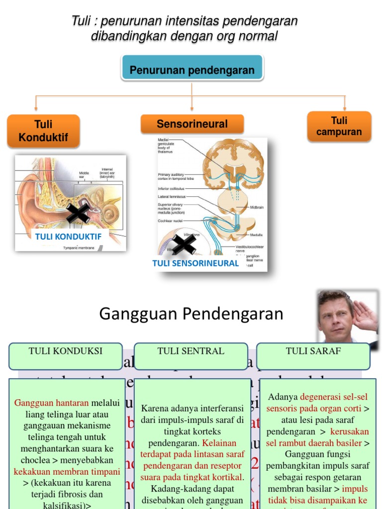 Mekanisme penurunan pendengaran pptx Mekanisme penurunan pendengaran pptx