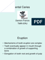 DENTAL CARIES.ppt