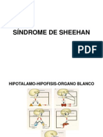 Sindrome de SHEEHAN