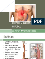 ergeyherniahiatal-130904220923-