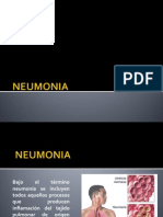 Neumonia