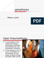 Open Pnuemothorax.ppt