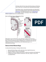 Hemorrhagic strokes include bleeding within the brain.docx