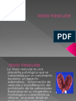 Mola Vesicular L Estupiñan