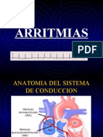 ARRITMIAS