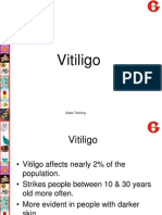 Vitiligo & Allopecia
